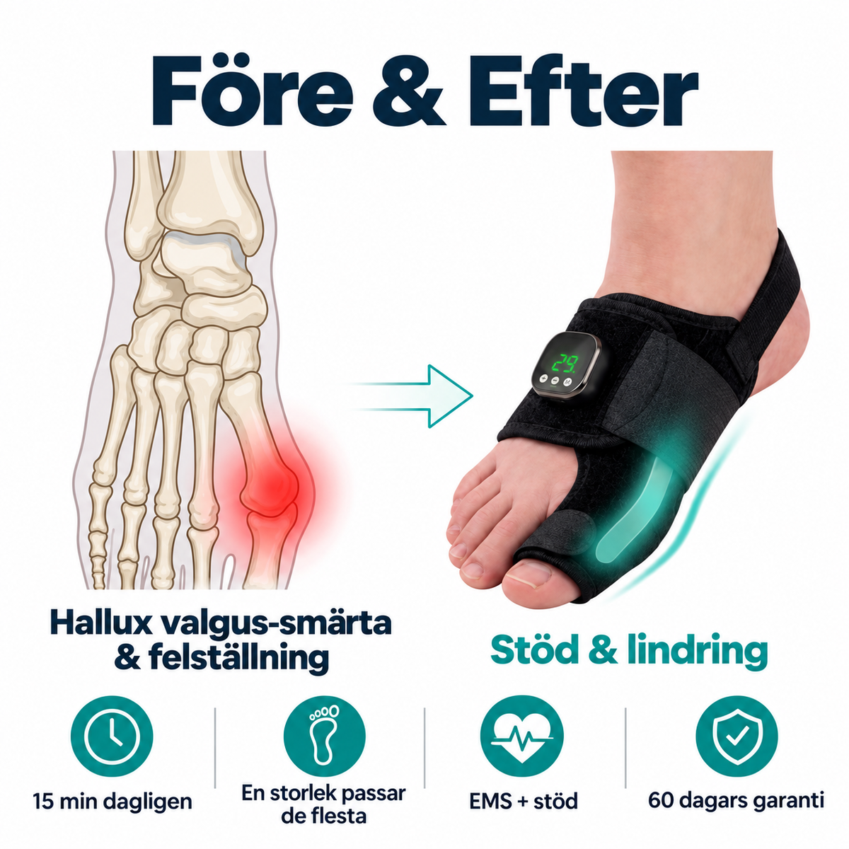 Fotiva™ EMS - Hallux Valgus Korrigerare